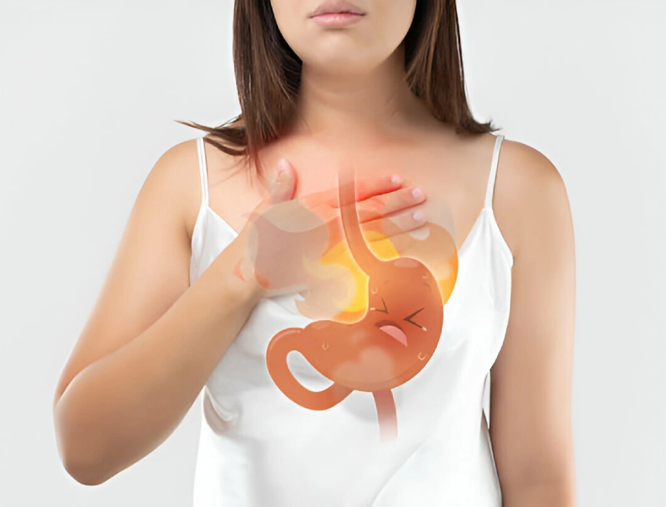 Benefits of Anti-Reflux Surgery