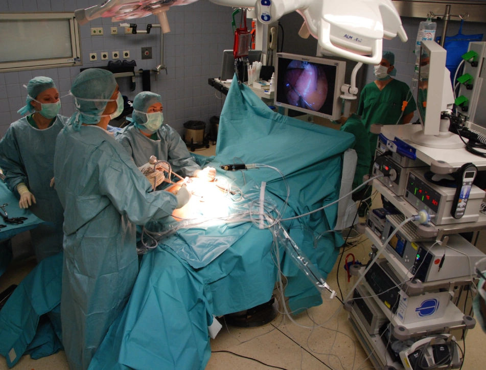 Gastric Band Removal Surgery by Sherif Awad