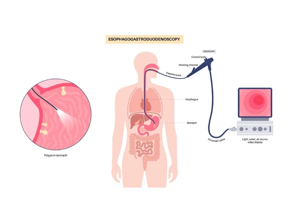 Gastroscopy Dubai