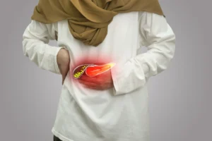 Illustration showing gallstones inside the gallbladder