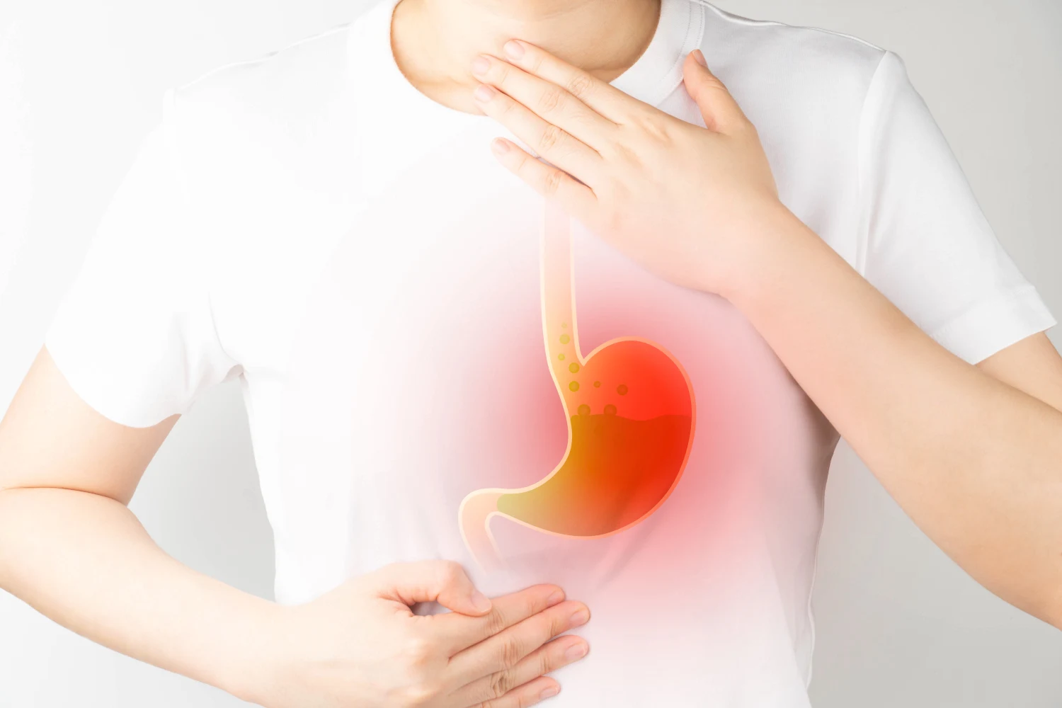 A patient experiencing GERD (gastroesophageal reflux disease)