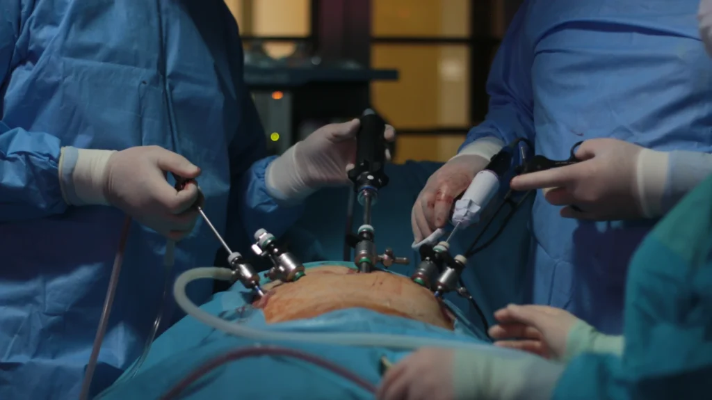 Surgeon Performing laparoscopic surgery